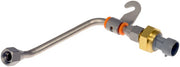 Delta Pressure Feedback Exhaust Gas Recirculation (EGR) Tube and Sensor Kit Dorman-OE Solutions 598-116